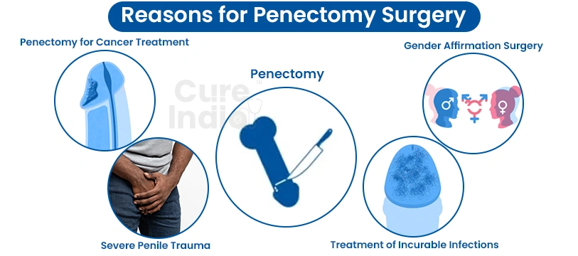 Reasons for penectomy surgery in India